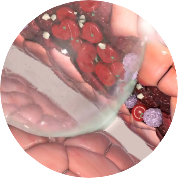 Company-Preserve-surgical-excellence