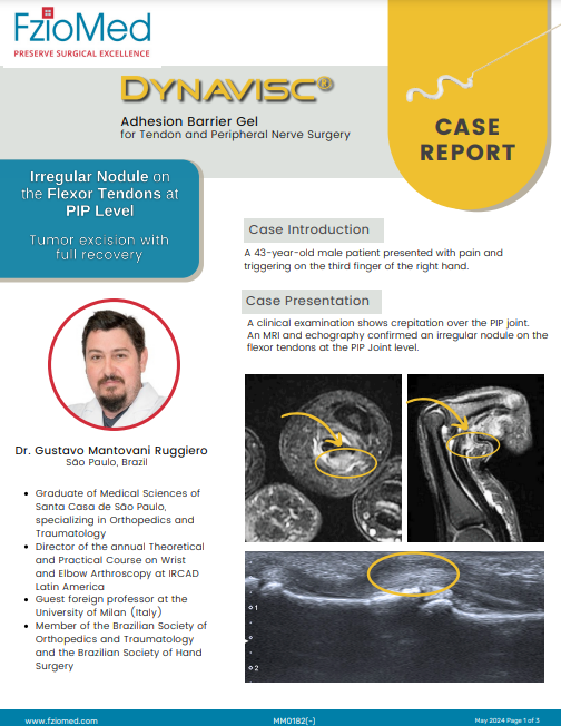 Dynavisc gel used in Irregular nodule on the flexor tendons at PIP level, Dr. Gustavo Mantovani Ruggiero, Case Report 2024